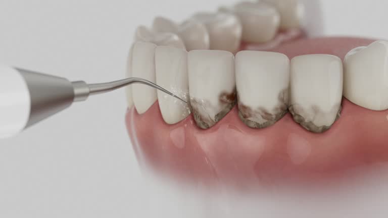 Reliable Dental contractor in Circleville, OH by Smile Center Dentistry